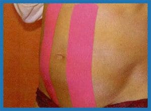 טיפול בתקופת ההריון