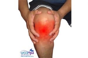 דלקת בגיד הפיקה של הברך