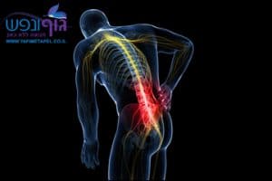 טיפול בכאבי גב תחתון