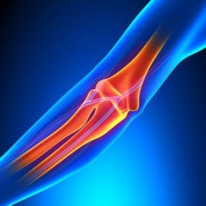 כאב מהעצב האולנרי