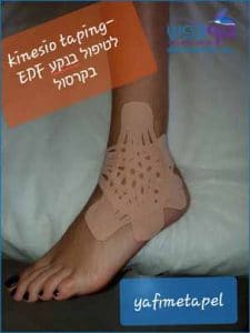 טיפול בנקע בקרסול עם טייפינג