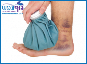 קירור הקרסול לאחר נקע