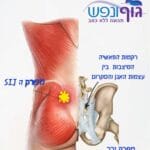 כאב גב תחתון ליד האגן, זה לא תמיד דיסק
