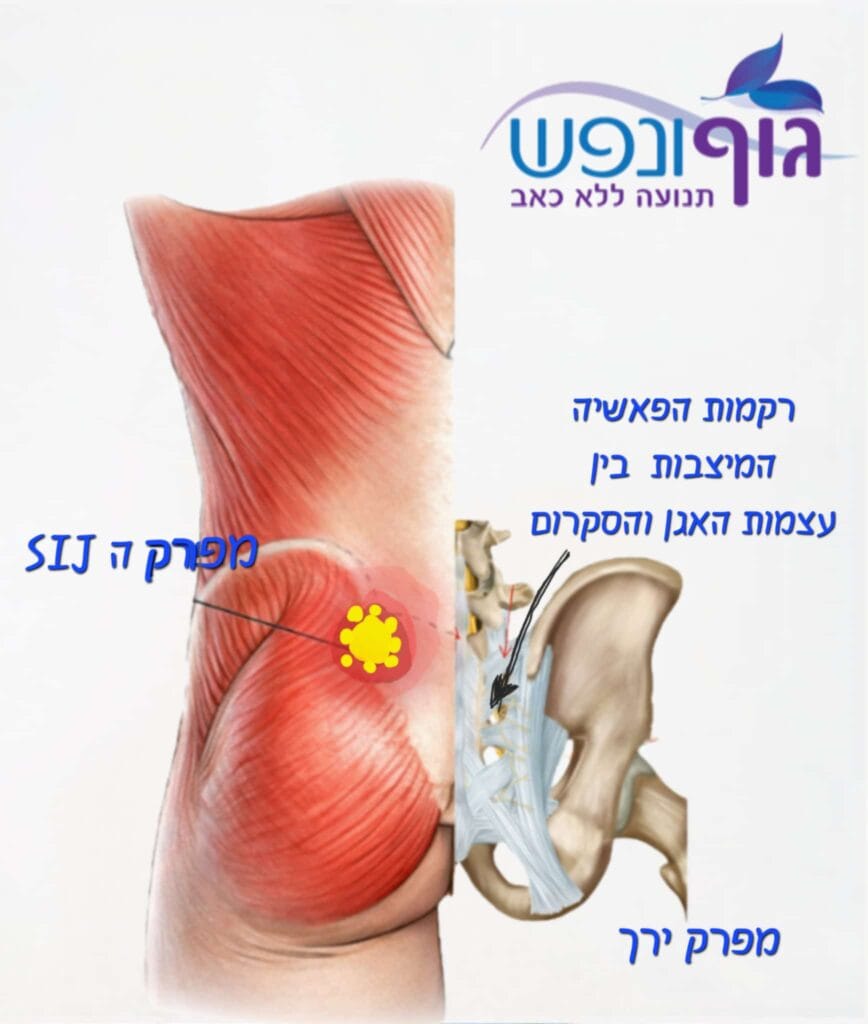 כאב נמוך בצד אחד ליד מפרק SIJ מעל הישבן