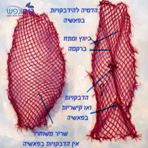 הדמיה של שכבות פאשיה וצלקת לאחר ניתוח והחזרת החלקה בין שכבות